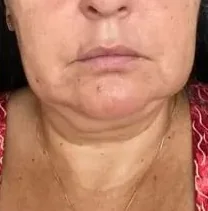 Aluna no início, região: Papada