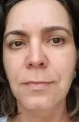 Mesma aluna no acompanhamento, região: Rosto