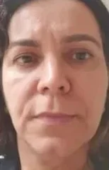Aluna no início, região: Rosto