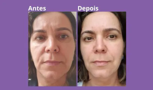 Aluna-Metodo-Face-Jovem-Foto-5 (1)